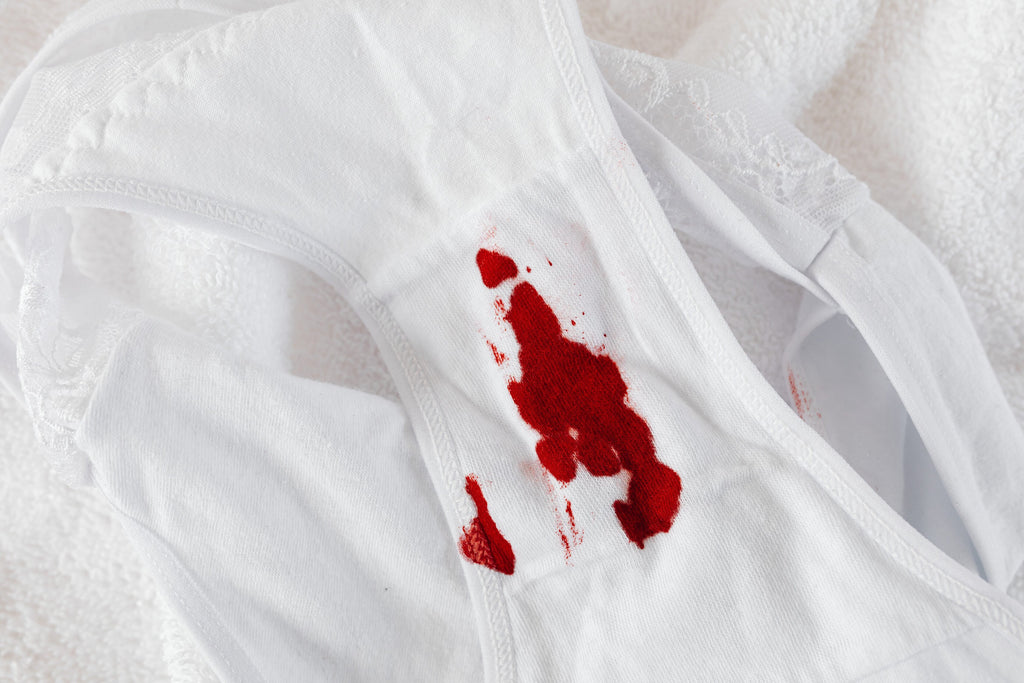 Say Goodbye to Period Stains: Easy Steps to Restore Your Favorite Undies